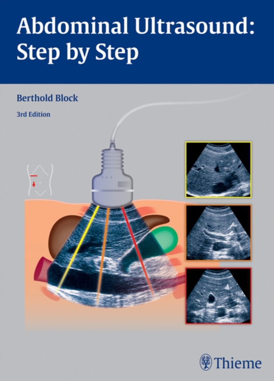 Abdominal Ultrasound: Step by Step (e-bog) af Block, Berthold