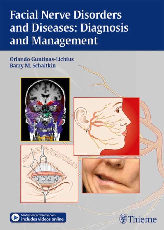 Facial Nerve Disorders and Diseases: Diagnosis and Management (e-bog) af Schaitkin, Barry