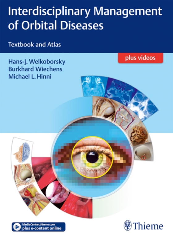 Interdisciplinary Management of Orbital Diseases