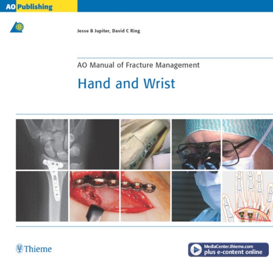 AO Manual of Fracture Management - Hand and Wrist (e-bog) af Ring, David