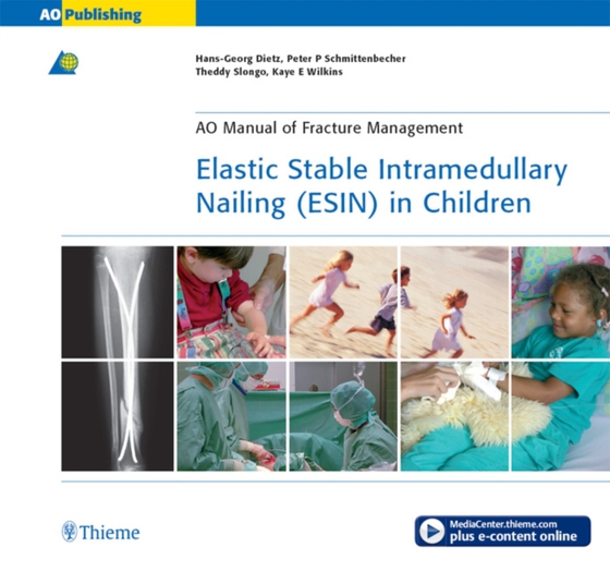 Elastic Stable Intramedullary Nailing (ESIN) in Children (e-bog) af Wilkins, Kaye E.