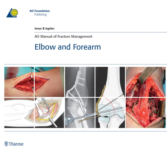 AO Manual of Fracture Management - Elbow and Forearm