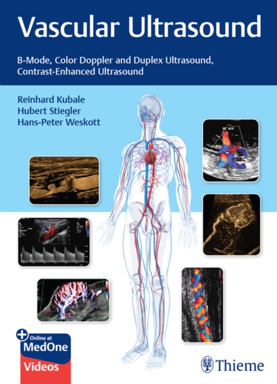 Vascular Ultrasound (e-bog) af -