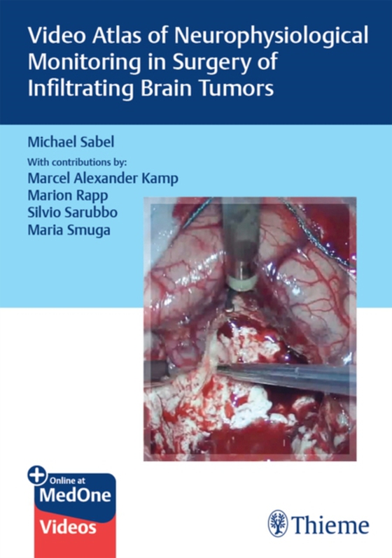 Video Atlas of Neurophysiological Monitoring in Surgery of Infiltrating Brain Tumors (e-bog) af Sabel, Michael