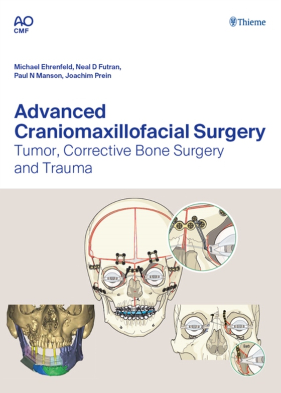 Advanced Craniomaxillofacial Surgery (e-bog) af -