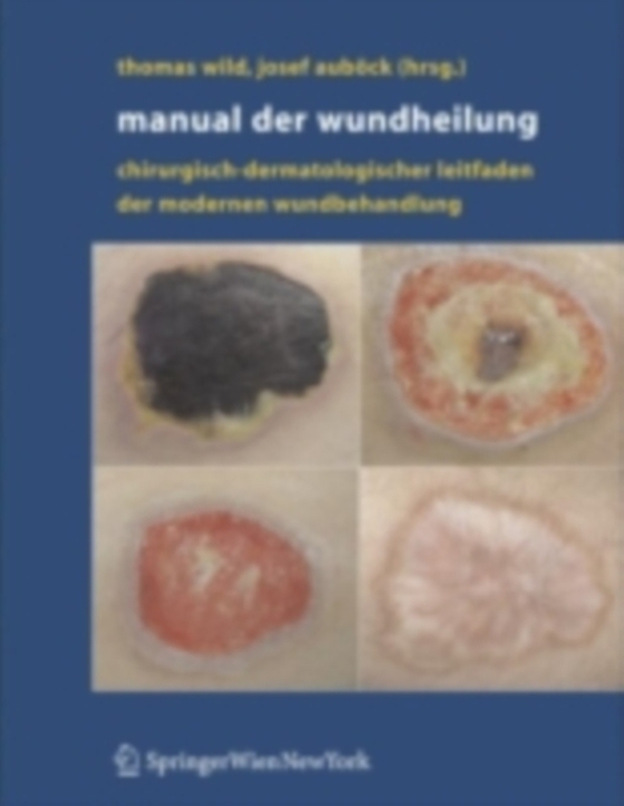 Manual der Wundheilung (e-bog) af -