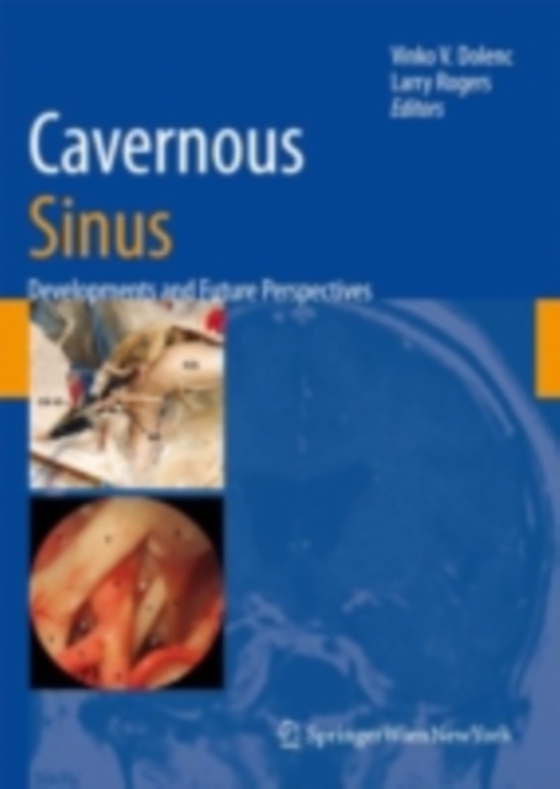 Cavernous Sinus