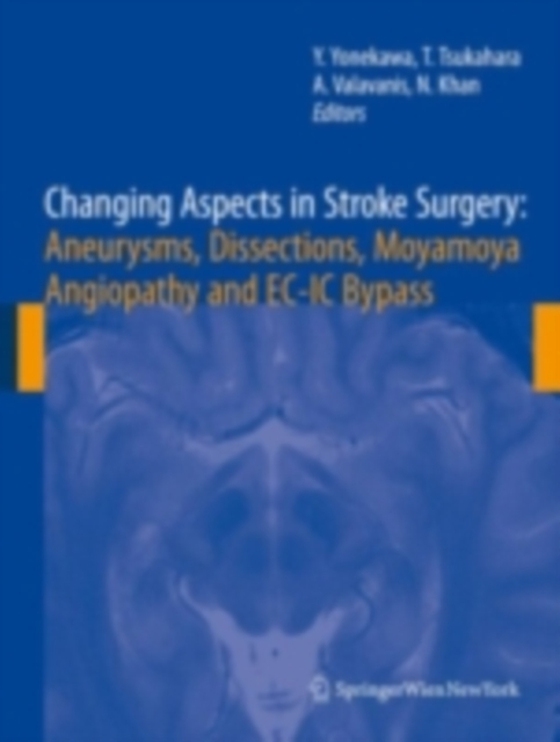 Changing Aspects in Stroke Surgery: Aneurysms, Dissection, Moyamoya angiopathy and EC-IC Bypass (e-bog) af -