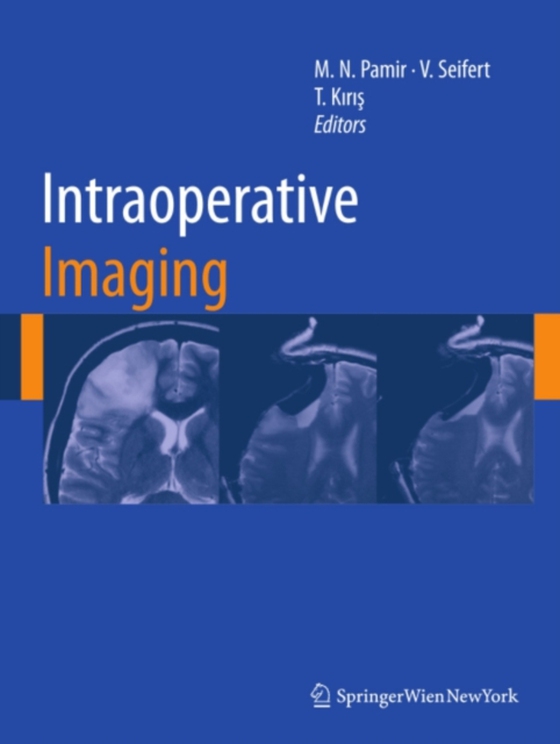 Intraoperative Imaging