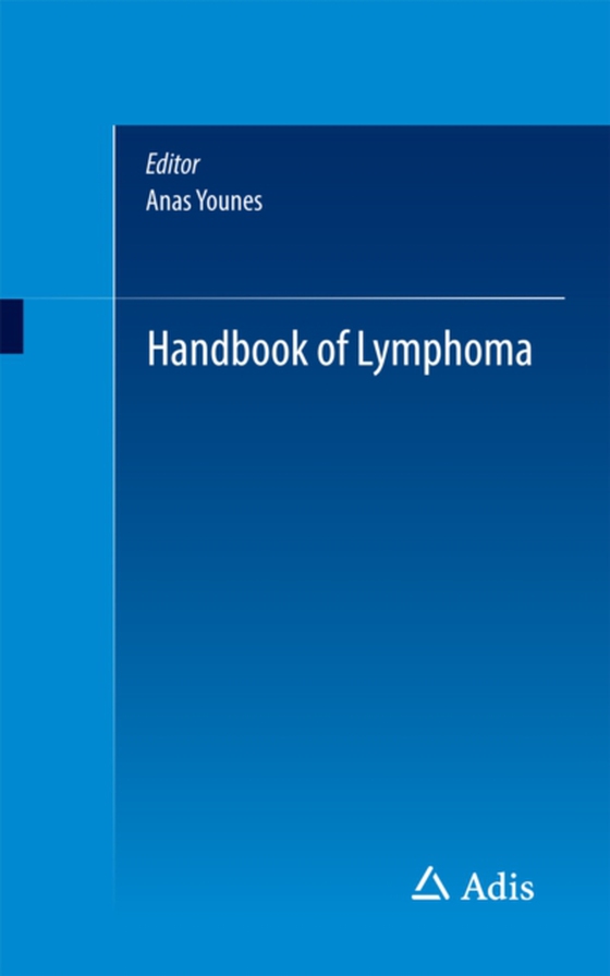 Handbook of Lymphoma (e-bog) af -