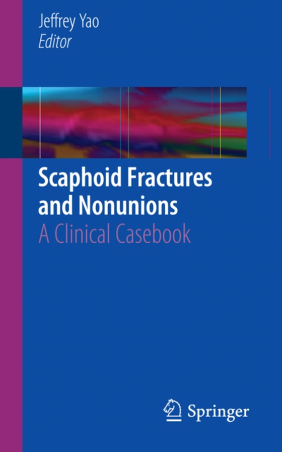 Scaphoid Fractures and Nonunions (e-bog) af -