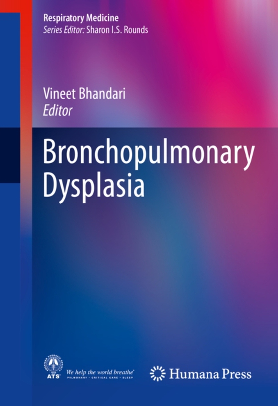 Bronchopulmonary Dysplasia (e-bog) af -