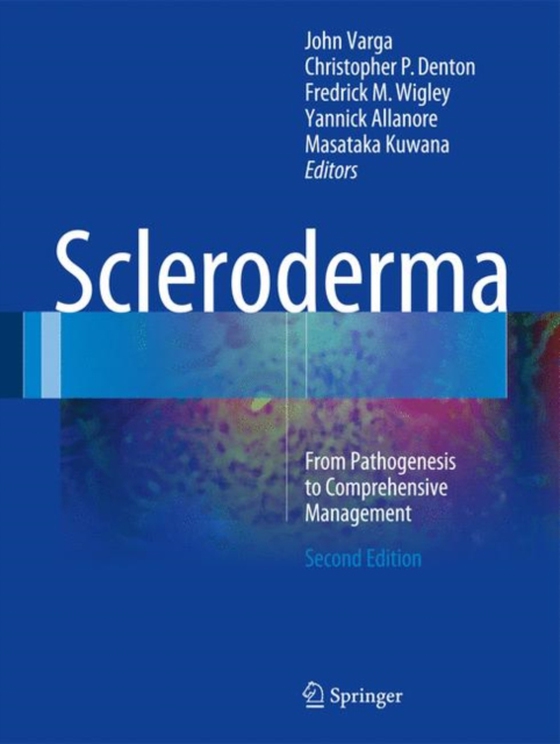 Scleroderma (e-bog) af -