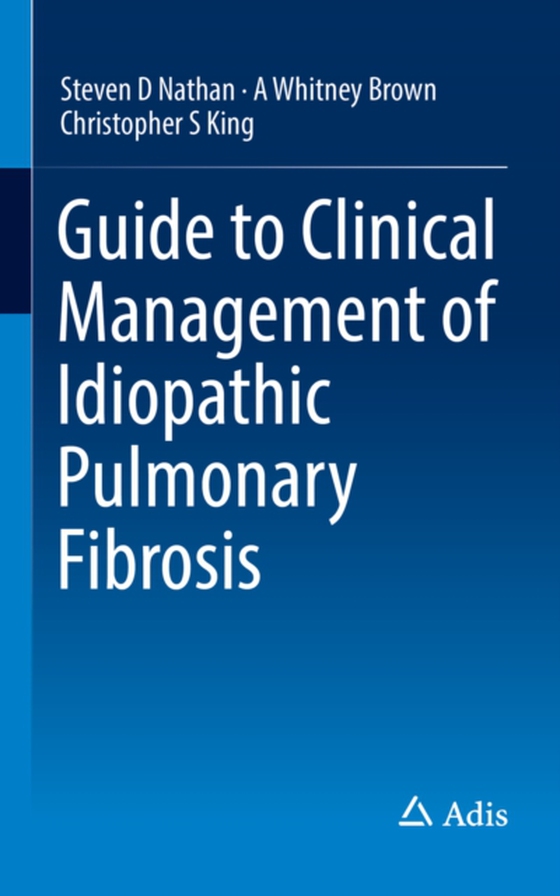 Guide to Clinical Management of Idiopathic Pulmonary Fibrosis (e-bog) af King, Christopher S