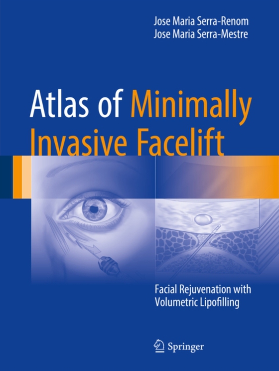 Atlas of Minimally Invasive Facelift (e-bog) af Serra-Mestre, Jose Maria