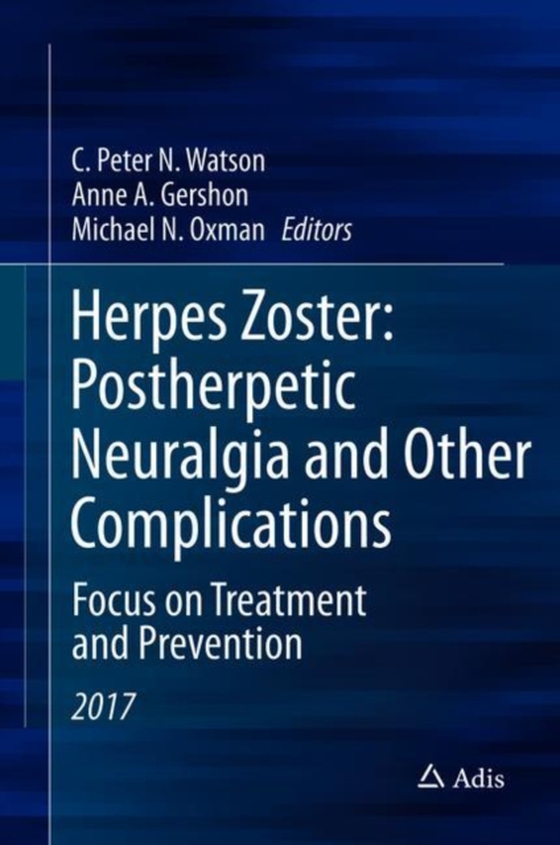 Herpes Zoster: Postherpetic Neuralgia and Other Complications (e-bog) af -