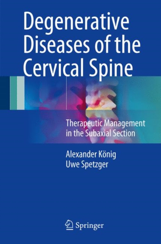 Degenerative Diseases of the Cervical Spine (e-bog) af Spetzger, Uwe