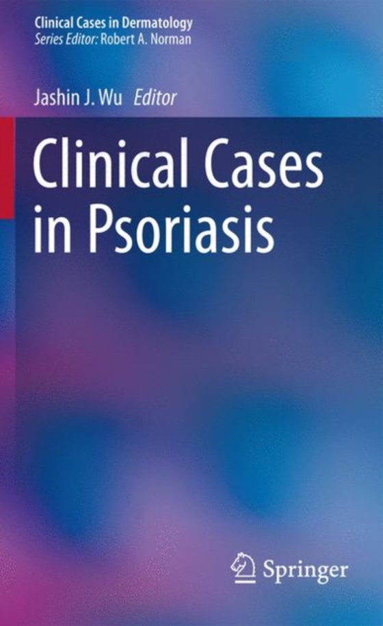 Clinical Cases in Psoriasis (e-bog) af -