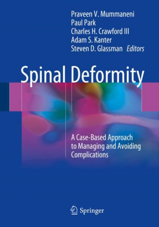 Spinal Deformity  (e-bog) af -