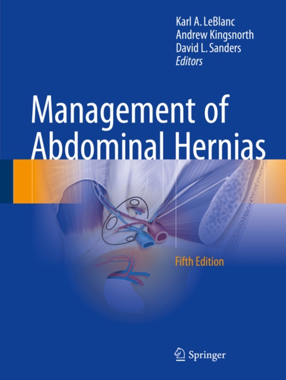 Management of Abdominal Hernias (e-bog) af -