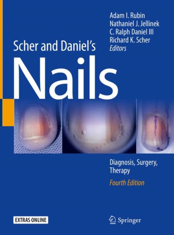 Scher and Daniel's Nails (e-bog) af -