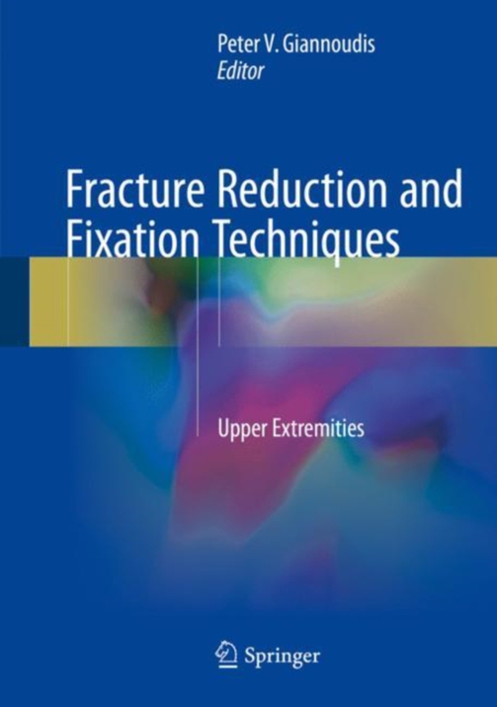 Fracture Reduction and Fixation Techniques (e-bog) af -