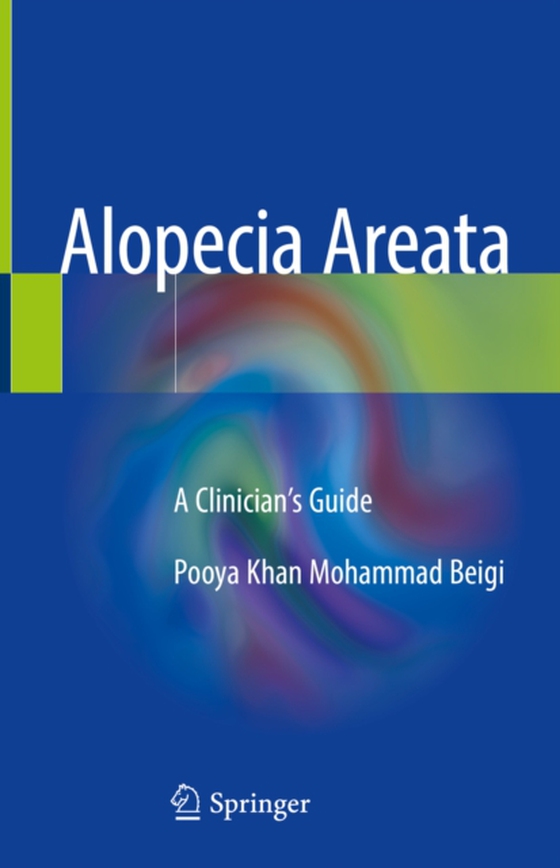 Alopecia Areata (e-bog) af Beigi, Pooya Khan Mohammad