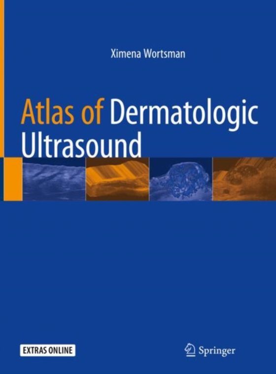 Atlas of Dermatologic Ultrasound (e-bog) af Wortsman, Ximena