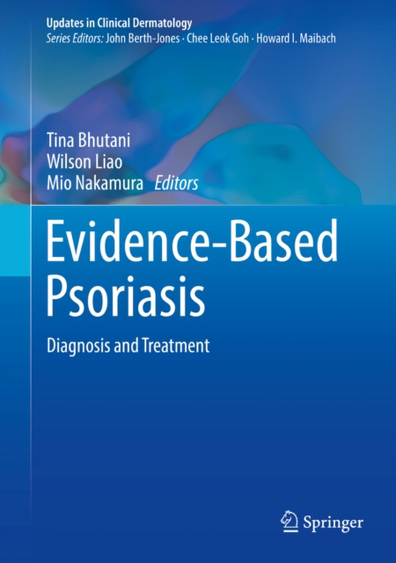 Evidence-Based Psoriasis (e-bog) af -