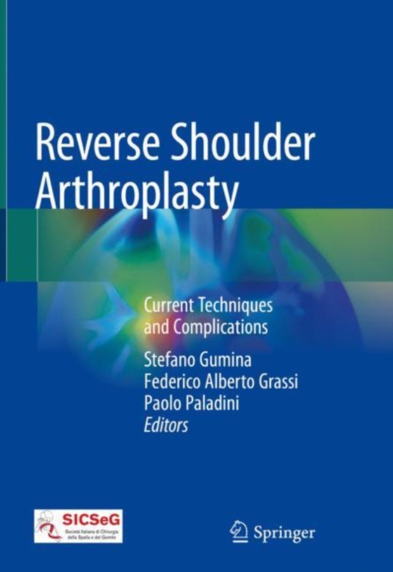 Reverse Shoulder Arthroplasty (e-bog) af -