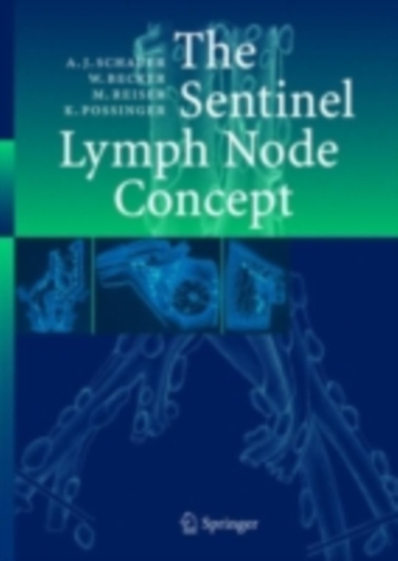 Sentinel Lymph Node Concept (e-bog) af Possinger, Kurt