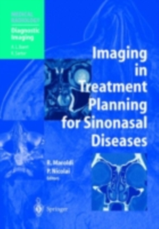 Imaging in Treatment Planning for Sinonasal Diseases (e-bog) af -