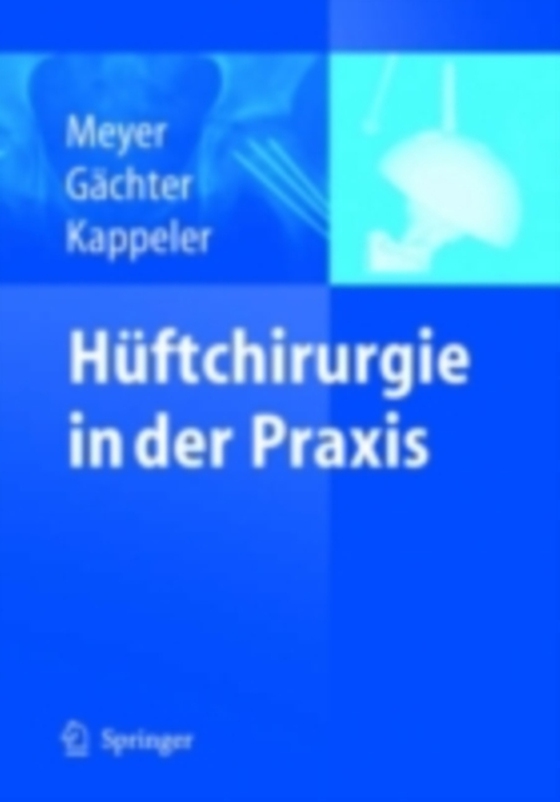 Hüftchirurgie in der Praxis