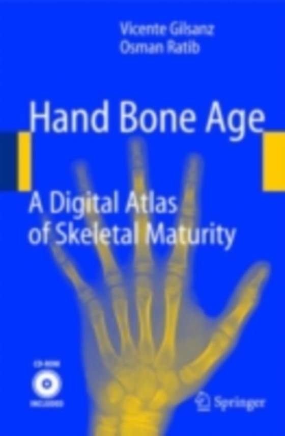 Hand Bone Age