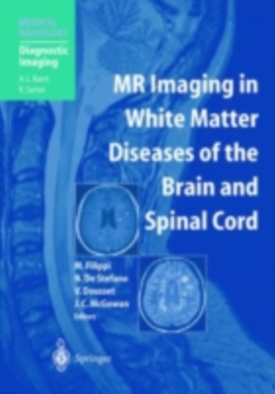 MR Imaging in White Matter Diseases of the Brain and Spinal Cord (e-bog) af -