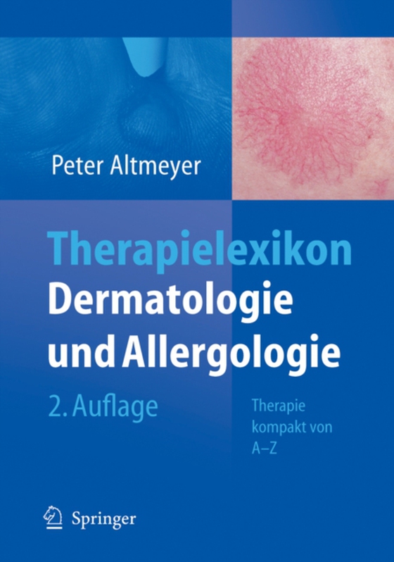 Therapielexikon Dermatologie und Allergologie (e-bog) af Altmeyer, Peter