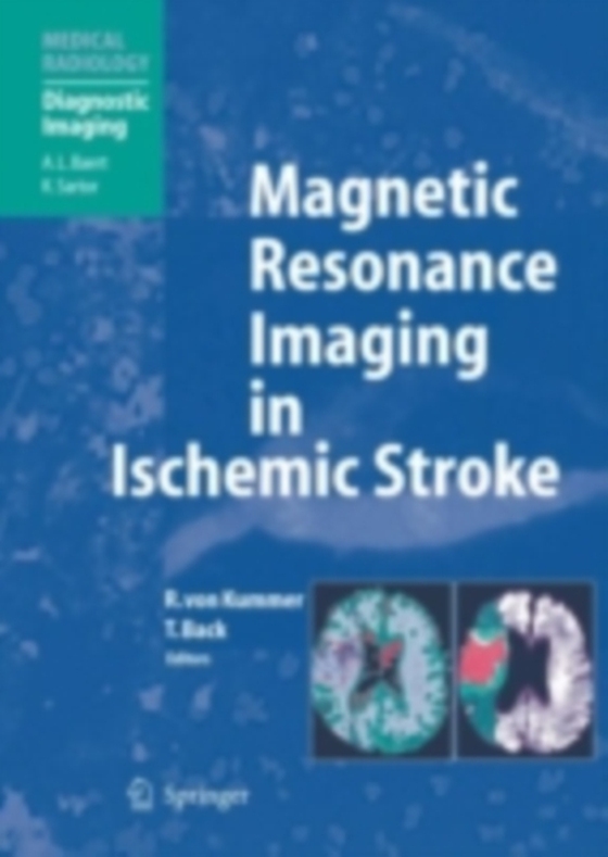 Magnetic Resonance Imaging in Ischemic Stroke (e-bog) af -