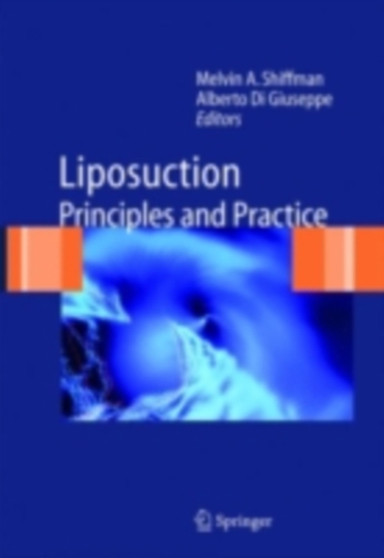 Liposuction (e-bog) af -