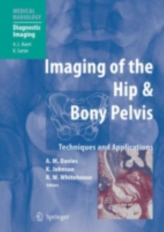 Imaging of the Hip & Bony Pelvis (e-bog) af -