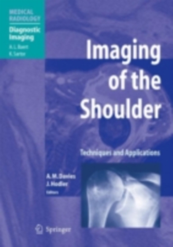 Imaging of the Shoulder (e-bog) af -