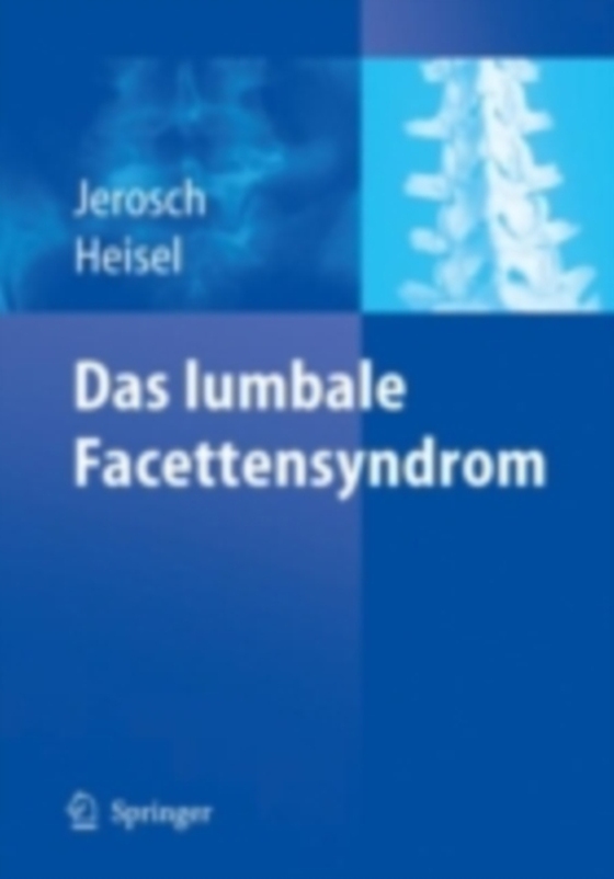 Das lumbale Facettensyndrom (e-bog) af Heisel, Jurgen