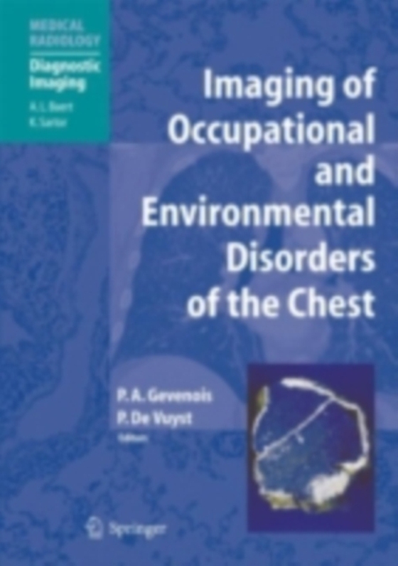 Imaging of Occupational and Environmental Disorders of the Chest (e-bog) af -