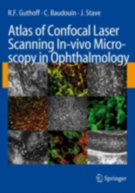 Atlas of Confocal Laser Scanning In-vivo Microscopy in Ophthalmology (e-bog) af Stave, J.