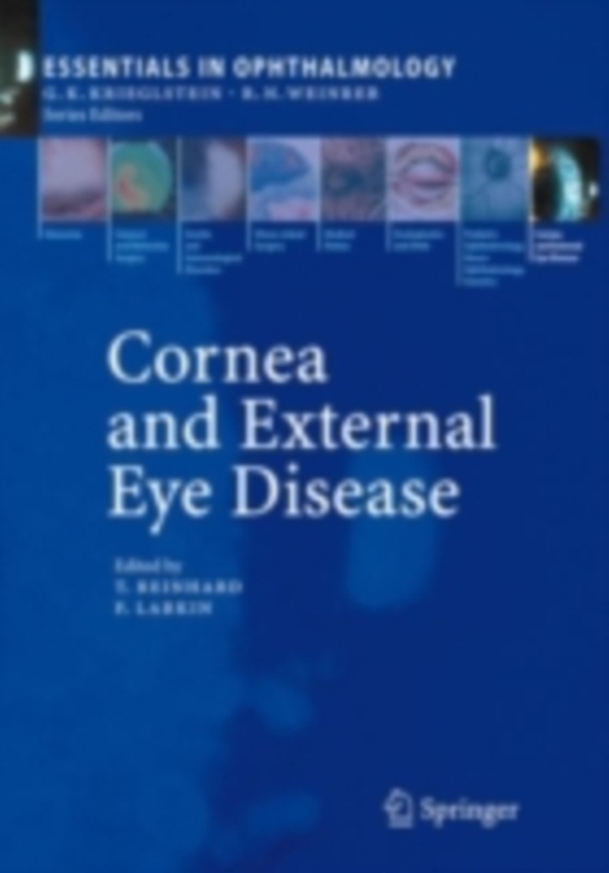 Cornea and External Eye Disease (e-bog) af -