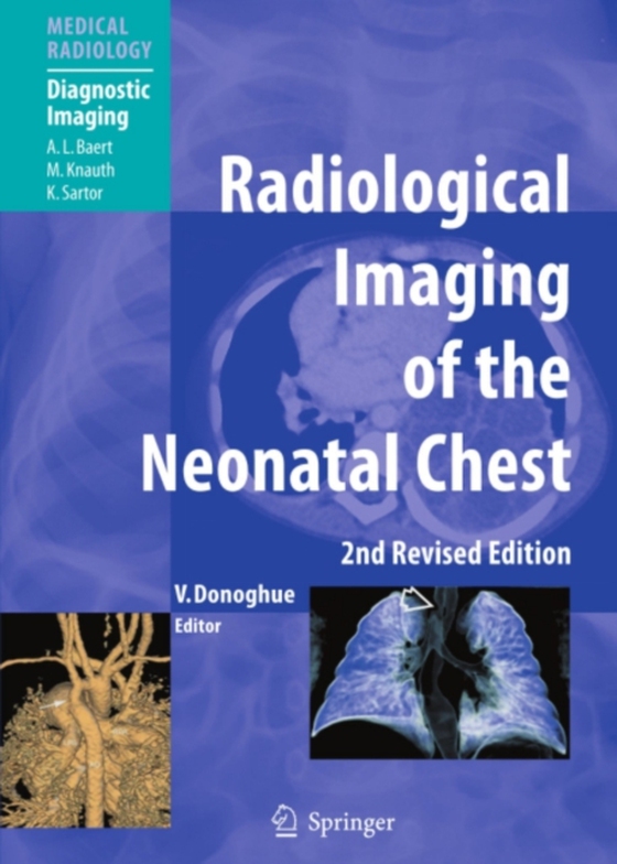 Radiological Imaging of the Neonatal Chest (e-bog) af -