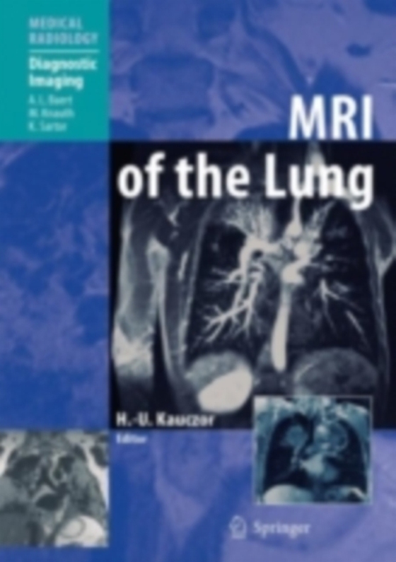 MRI of the Lung (e-bog) af -