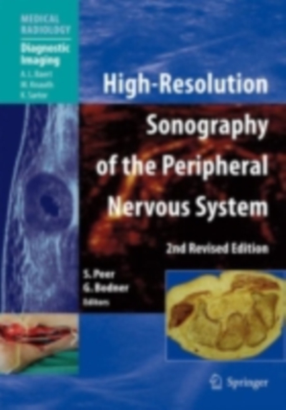 High-Resolution Sonography of the Peripheral Nervous System (e-bog) af -