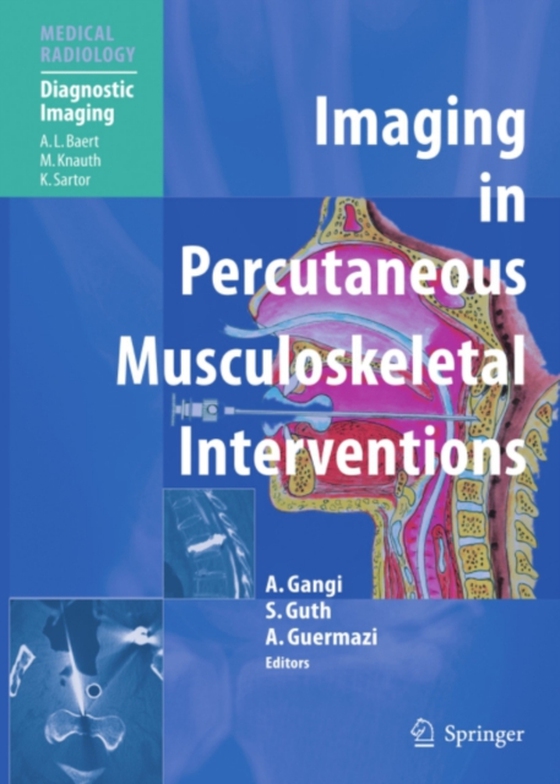 Imaging in Percutaneous Musculoskeletal Interventions (e-bog) af -