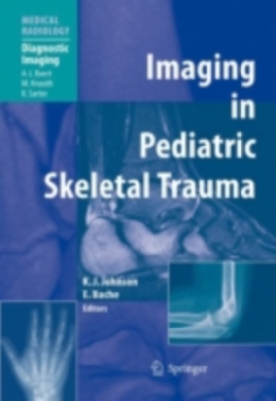 Imaging in Pediatric Skeletal Trauma (e-bog) af -