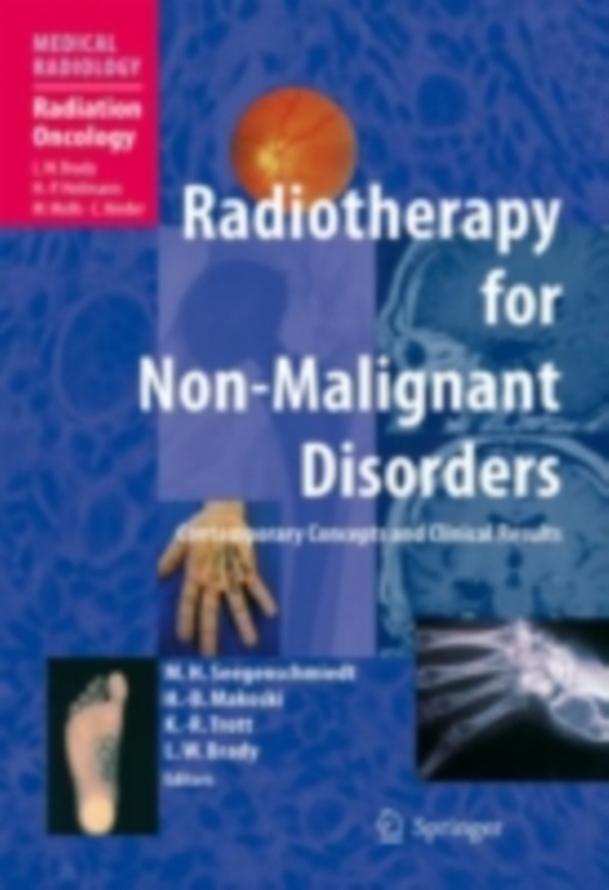 Radiotherapy for Non-Malignant Disorders  (e-bog) af -